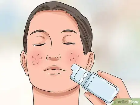 Image titled Get Rid of Large Pores and Blemishes Step 16