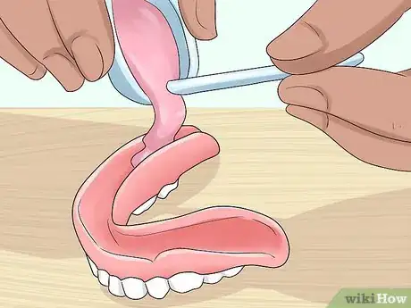 Image titled Keep Bottom Dentures in Place Step 16