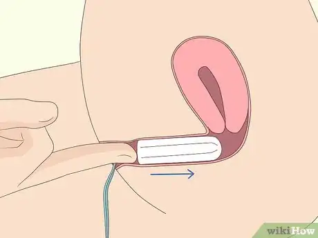 Image titled Insert a Tampon Without Applicator Step 8