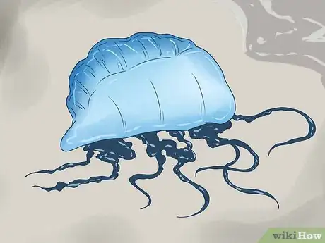 Image titled Treat a Portuguese Man O' War Sting (Bluebottle Sting) Step 14