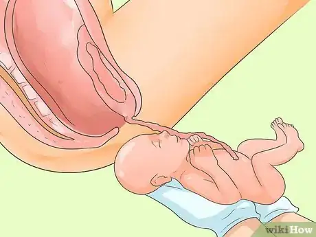 Image titled Deliver a Baby Step 18