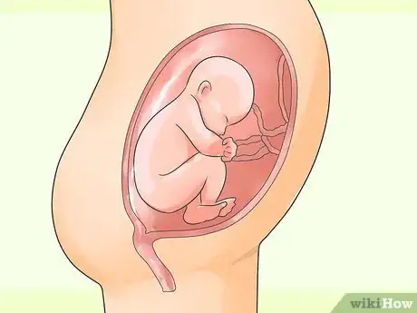 Image titled Deliver a Baby Step 15