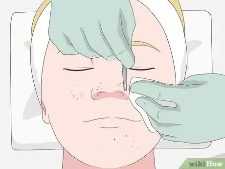 Image titled Clean Clogged Pores Step 5