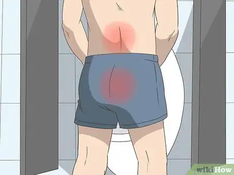 Image titled Reduce Prostate Pain Step 1