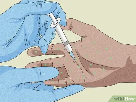 Image titled Stop Sweaty Hands While Gaming Step 8