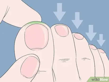 Image titled Use Reflexology for Migraines Step 1