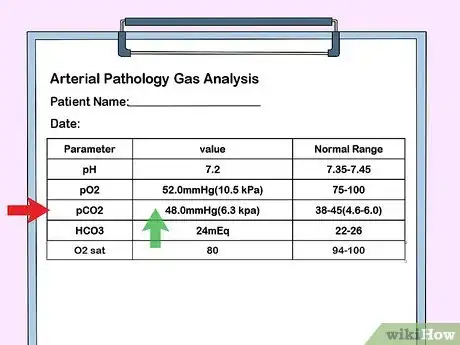 Image titled Interpret Blood Gas Results Step 4