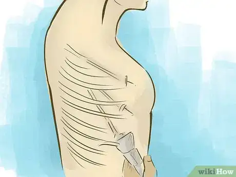 Image titled Stop Armpit Sweating Step 13