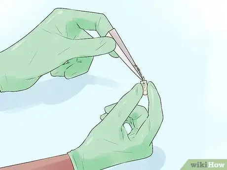 Image titled Insert Boric Acid Suppositories Step 12