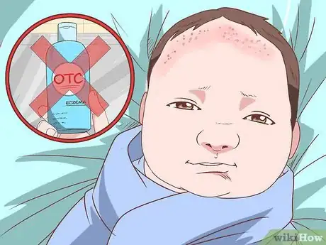 Image titled Heal Scalp Eczema Step 18