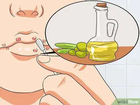 Image titled Ease Herpes Pain with Home Remedies Step 6