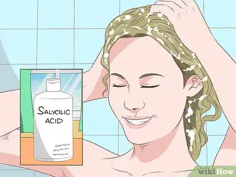 Image titled Heal Scalp Eczema Step 13