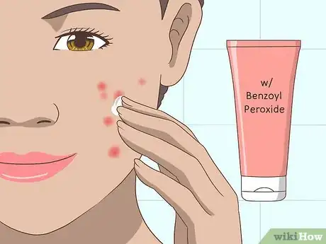 Image titled Prevent Oily Skin Step 6