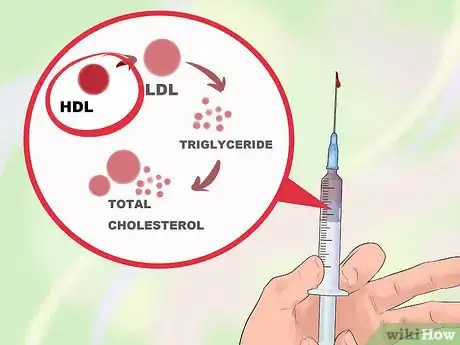 Image titled Test for Insulin Resistance Step 6