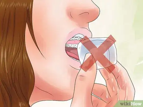 Image titled Eat With Braces Step 4