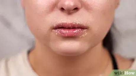 Image titled Make Honey Lip Scrub Step 5