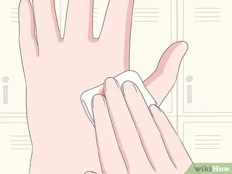 Image titled Stop Warts from Bleeding Step 1