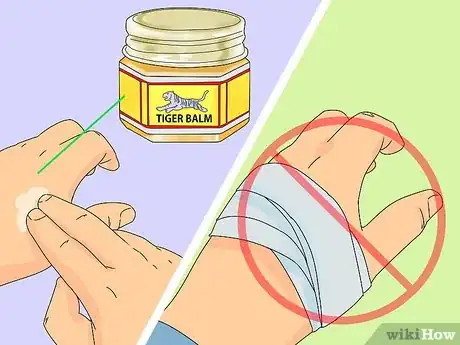 Image titled Use Tiger Balm Step 11