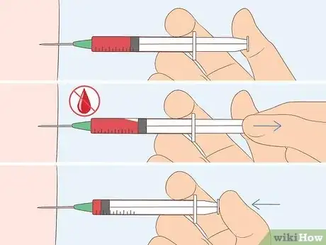 Image titled Give a B12 Injection Step 11