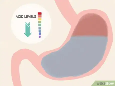 Image titled Use Ginger for Acid Reflux Step 6