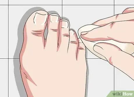 Image titled Do a Self Pedicure Step 15