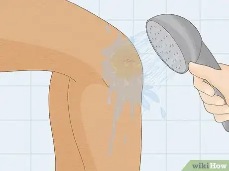 Image titled Remove Iodine Stains from Skin Step 4