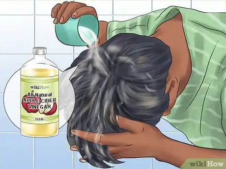 Image titled Get Rid of Lice Step 6