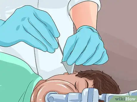 Image titled Know if You Have Otitis Media Step 22