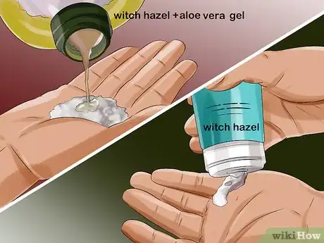 Image titled Apply Witch Hazel to Your Face Step 9