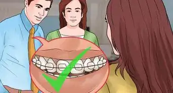 Make Braces Look Less Noticeable