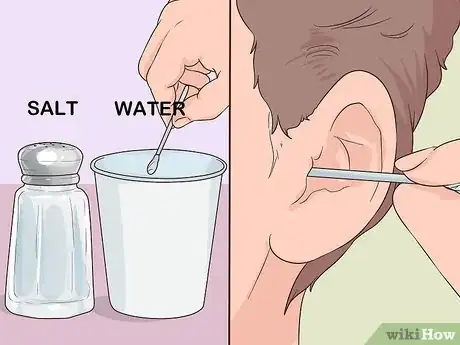 Image titled Remove Ear Hair Step 1