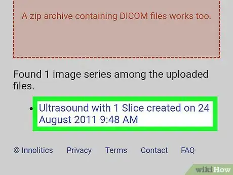 Image titled Open a DICOM File on Android Step 6