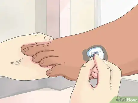 Image titled Give Someone a Pedicure Step 4