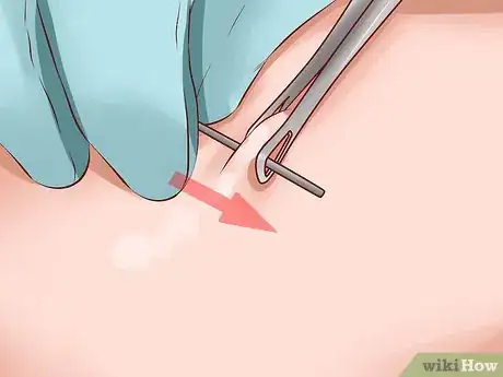 Image titled Do a Self Piercing at Home Step 6