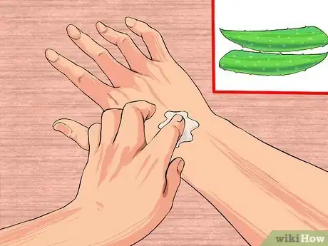 Image titled Use Aloe Vera to Treat Rheumatoid Arthritis Step 3