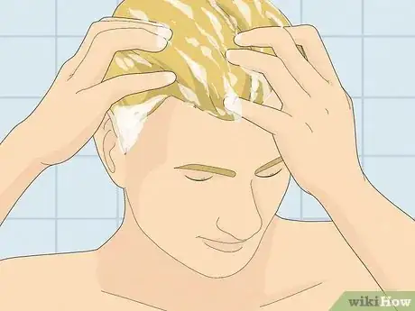 Image titled Make Your Scalp Stop Itching Step 3