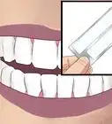 Get Perfect Teeth