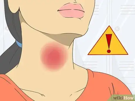 Image titled Treat Thyroid Problems Step 1