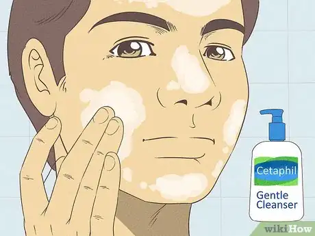 Image titled Wash Your Face when You Have a Sensitive Skin Step 7