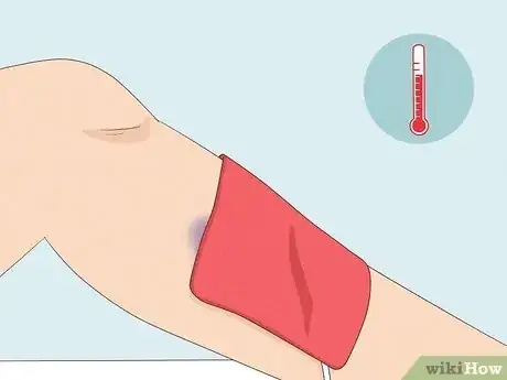 Image titled Get Rid of Bruises with Toothpaste Step 10