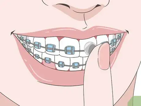 Image titled Eat Food With New or Tightened Braces Step 8