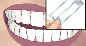 Get Perfect Teeth