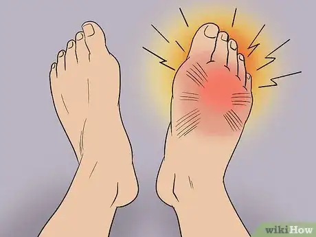 Image titled Treat Pain at the Top of the Foot Step 5