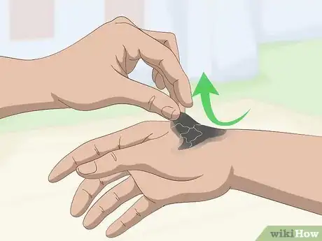 Image titled Remove Tar From Skin Step 6