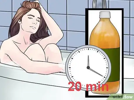 Image titled Relieve Vaginal Burning Step 14