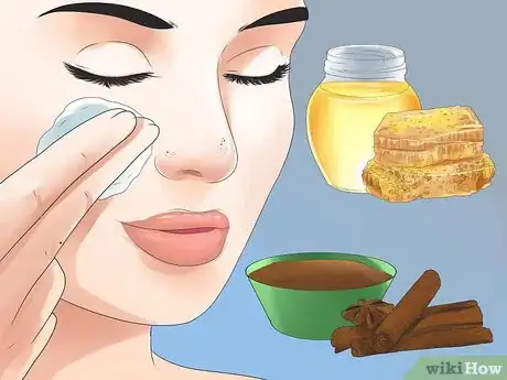 Image titled Remove Blackheads Step 1