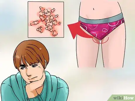 Image titled Have Sex with Someone with Herpes Step 1