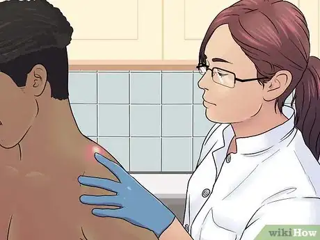 Image titled Remove a Sebaceous Cyst Step 2