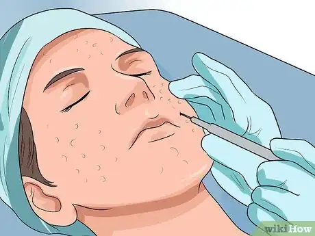 Image titled Get Rid of Large Pores and Blemishes Step 17