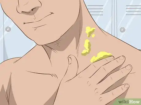 Image titled Get Rid of Neck Acne Step 15